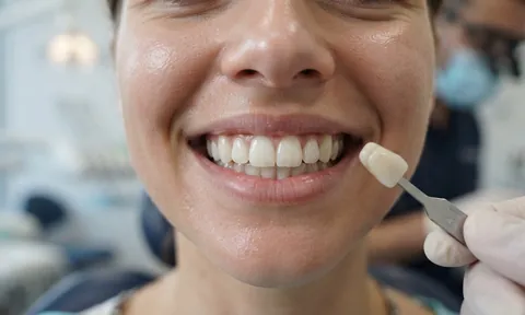 Close-up of a bright smile beside a dental shade guide